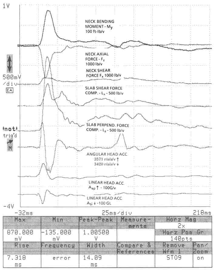 Hodgson study figure b