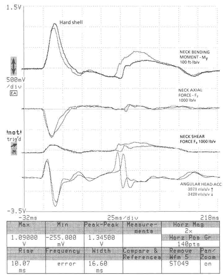 Hodgson study figure g